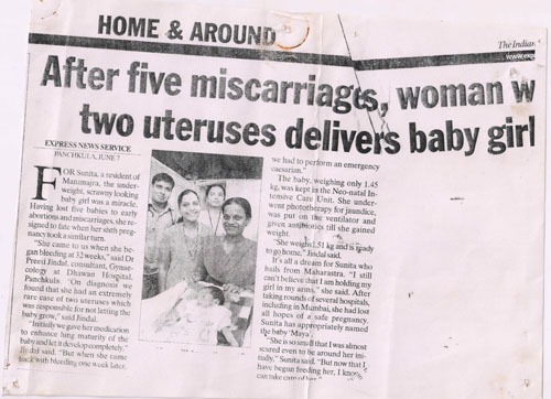 after five miscarrinages, woman w two uteruses delivers baby girl