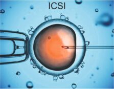 ICSI - Touch Clinic